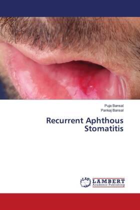 Bansal |  Recurrent Aphthous Stomatitis | Buch |  Sack Fachmedien