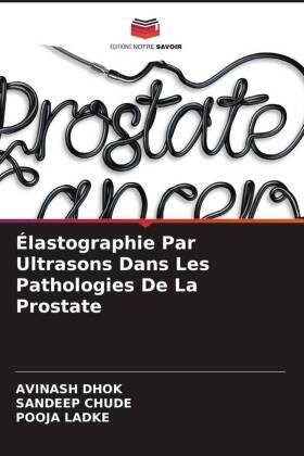 Dhok / Chude / Ladke |  Élastographie Par Ultrasons Dans Les Pathologies De La Prostate | Buch |  Sack Fachmedien