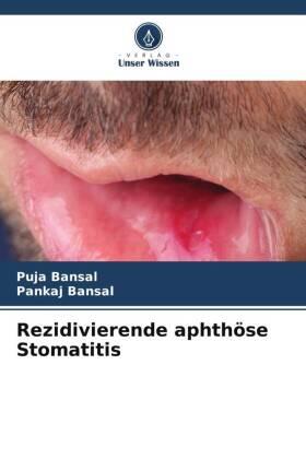 Bansal |  Rezidivierende aphthöse Stomatitis | Buch |  Sack Fachmedien