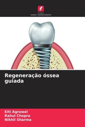 Agrawal / Chopra / Sharma |  Regeneração óssea guiada | Buch |  Sack Fachmedien