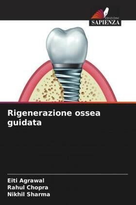 Agrawal / Chopra / Sharma |  Rigenerazione ossea guidata | Buch |  Sack Fachmedien
