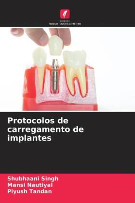 Singh / Nautiyal / Tandan |  Protocolos de carregamento de implantes | Buch |  Sack Fachmedien