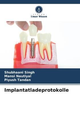 Singh / Nautiyal / Tandan |  Implantatladeprotokolle | Buch |  Sack Fachmedien