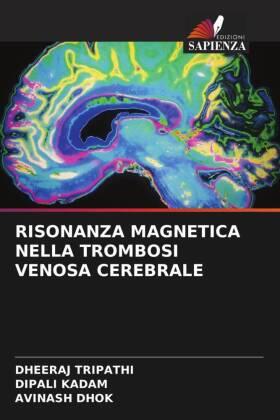 Tripathi / Kadam / Dhok |  RISONANZA MAGNETICA NELLA TROMBOSI VENOSA CEREBRALE | Buch |  Sack Fachmedien