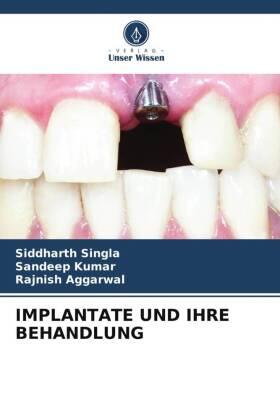 Singla / Kumar / Aggarwal |  IMPLANTATE UND IHRE BEHANDLUNG | Buch |  Sack Fachmedien