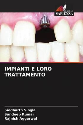 Singla / Kumar / Aggarwal |  IMPIANTI E LORO TRATTAMENTO | Buch |  Sack Fachmedien