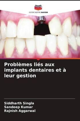 Singla / Kumar / Aggarwal |  Problèmes liés aux implants dentaires et à leur gestion | Buch |  Sack Fachmedien