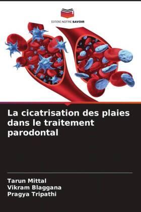 Mittal / Blaggana / Tripathi |  La cicatrisation des plaies dans le traitement parodontal | Buch |  Sack Fachmedien