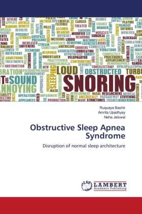 Bashir / Upadhyay / Jaiswal |  Obstructive Sleep Apnea Syndrome | Buch |  Sack Fachmedien