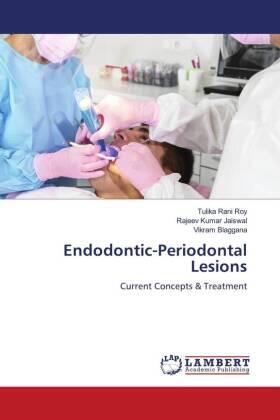 Roy / Jaiswal / Blaggana |  Endodontic-Periodontal Lesions | Buch |  Sack Fachmedien