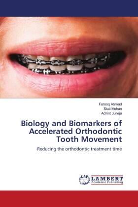 Ahmad / Mohan / Juneja |  Biology and Biomarkers of Accelerated Orthodontic Tooth Movement | Buch |  Sack Fachmedien