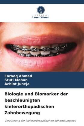 Ahmad / Mohan / Juneja |  Biologie und Biomarker der beschleunigten kieferorthopädischen Zahnbewegung | Buch |  Sack Fachmedien