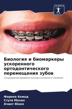 Ahmad / Mohan / Juneq |  Biologiq i biomarkery uskorennogo ortodonticheskogo peremescheniq zubow | Buch |  Sack Fachmedien