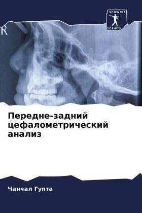 Gupta |  Peredne-zadnij cefalometricheskij analiz | Buch |  Sack Fachmedien