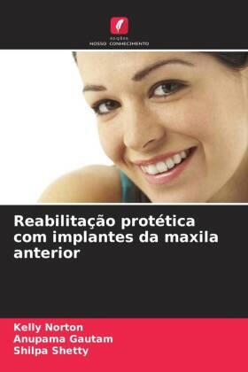 Norton / Gautam / Shetty |  Reabilitação protética com implantes da maxila anterior | Buch |  Sack Fachmedien