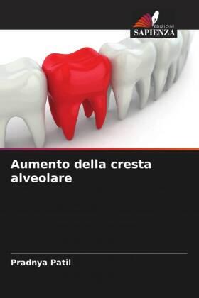 Patil / Agrawal |  Aumento della cresta alveolare | Buch |  Sack Fachmedien