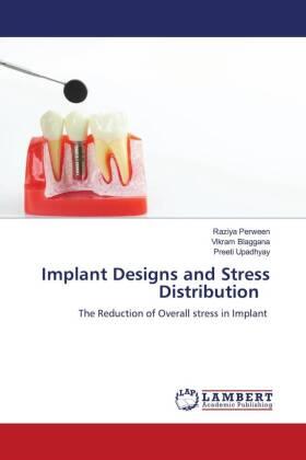 Perween / Blaggana / Upadhyay |  Implant Designs and Stress Distribution | Buch |  Sack Fachmedien