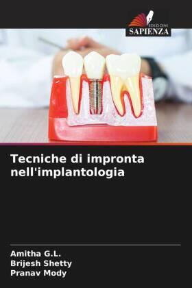G. L. / Shetty / Mody |  Tecniche di impronta nell'implantologia | Buch |  Sack Fachmedien