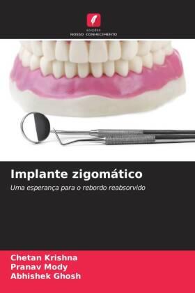 Krishna / Mody / Ghosh |  Implante zigomático | Buch |  Sack Fachmedien