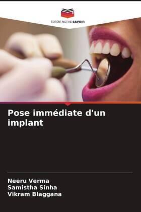 Verma / Sinha / Blaggana |  Pose immédiate d'un implant | Buch |  Sack Fachmedien