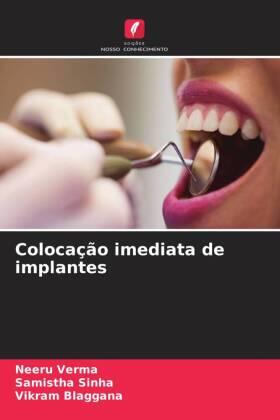 Verma / Sinha / Blaggana |  Colocação imediata de implantes | Buch |  Sack Fachmedien