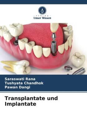 Rana / Chandhok / Dangi |  Transplantate und Implantate | Buch |  Sack Fachmedien