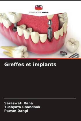 Rana / Chandhok / Dangi |  Greffes et implants | Buch |  Sack Fachmedien