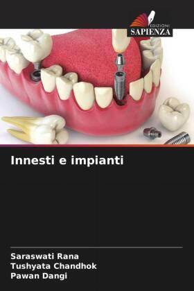 Rana / Chandhok / Dangi |  Innesti e impianti | Buch |  Sack Fachmedien