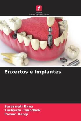 Rana / Chandhok / Dangi |  Enxertos e implantes | Buch |  Sack Fachmedien