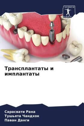 Rana / Chandhok / Dangi |  Transplantaty i implantaty | Buch |  Sack Fachmedien