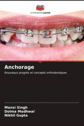 Singh / Madhwal / Gupta |  Anchorage | Buch |  Sack Fachmedien