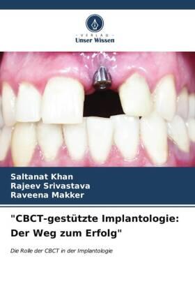 Khan / Srivastava / Makker |  "CBCT-gestützte Implantologie: Der Weg zum Erfolg" | Buch |  Sack Fachmedien