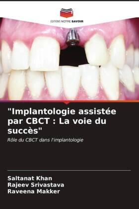 Khan / Srivastava / Makker |  "Implantologie assistée par CBCT : La voie du succès" | Buch |  Sack Fachmedien