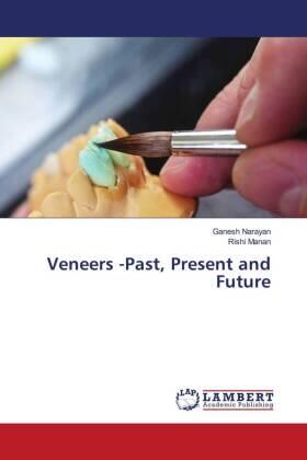 Narayan / Manan |  Veneers -Past, Present and Future | Buch |  Sack Fachmedien