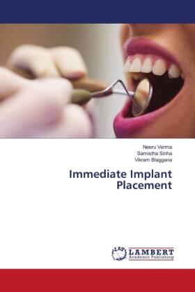 Verma / Sinha / Blaggana |  Immediate Implant Placement | Buch |  Sack Fachmedien
