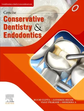 Gupta / Hegde / Prakash |  Concise Conservative Dentistry and Endodontics | Buch |  Sack Fachmedien