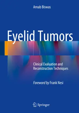 Biswas | Eyelid Tumors | E-Book | www2.sack.de