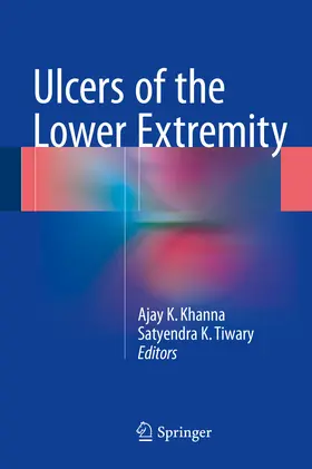 Khanna / Tiwary |  Ulcers of the Lower Extremity | eBook | Sack Fachmedien