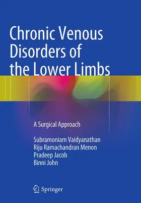 Vaidyanathan / John / Menon |  Chronic Venous Disorders of the Lower Limbs | Buch |  Sack Fachmedien