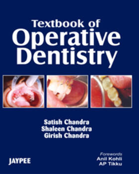 Garg |  Textbook of Operative Dentistry | Buch |  Sack Fachmedien