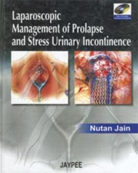 Jain |  Laparoscopic Management of Prolapse and Stress Urinary Incontinence | Buch |  Sack Fachmedien