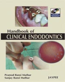 Mathur |  A Hand Book of Clinical Endodontics | Buch |  Sack Fachmedien