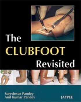 Pandey |  The Club Foot Revisited | Buch |  Sack Fachmedien