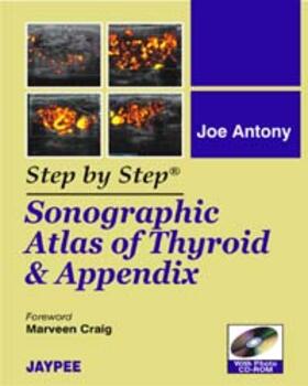 Antony |  Step by Step: Sonographic Atlas of Thyroid and Appendix | Buch |  Sack Fachmedien