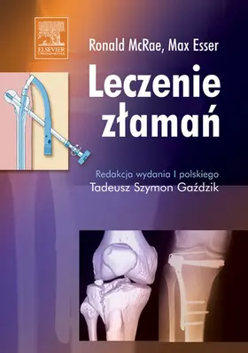 McRae |  Leczenie zlaman | eBook | Sack Fachmedien