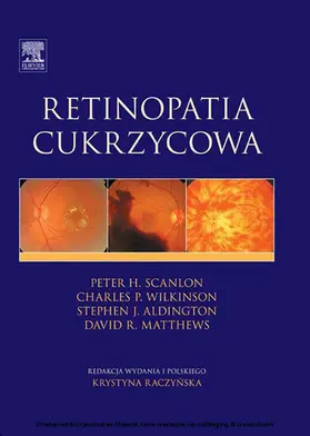 Aldington | Retinopatia cukrzycowa | E-Book | sack.de