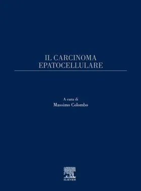 Colombo |  Il carcinoma epatocellulare | eBook | Sack Fachmedien