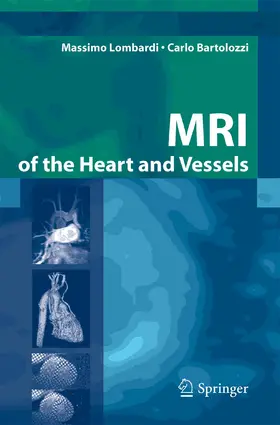 Lombardi / Bartolozzi |  MRI of the Heart and Vessels | eBook | Sack Fachmedien