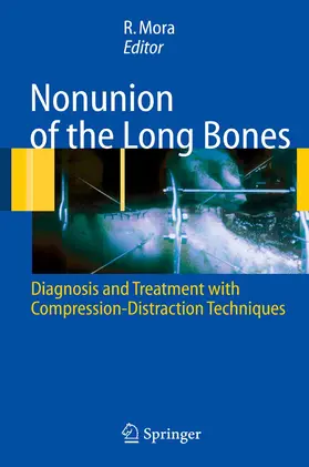 Mora |  Nonunion of the Long Bones | eBook | Sack Fachmedien