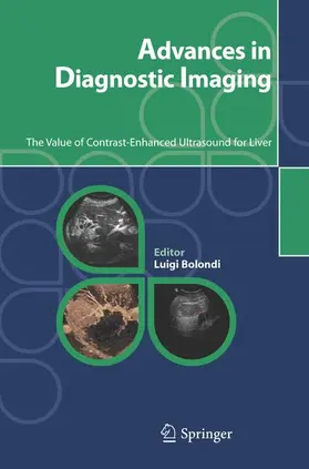 Bolondi | Advances in Diagnostic Imaging | Buch | 978-88-470-0457-3 | www2.sack.de